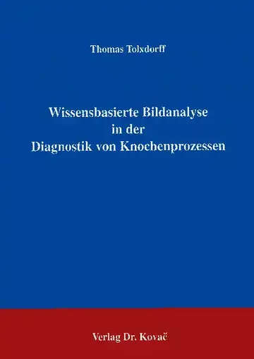 Tolxdoff: Wissensbasierte Bildanalyse in der Diagnostik von Knochenprozessen