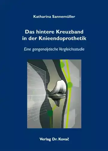 Katharina Sannemüller: Das hintere Kreuzband in der Knieendoprothetik