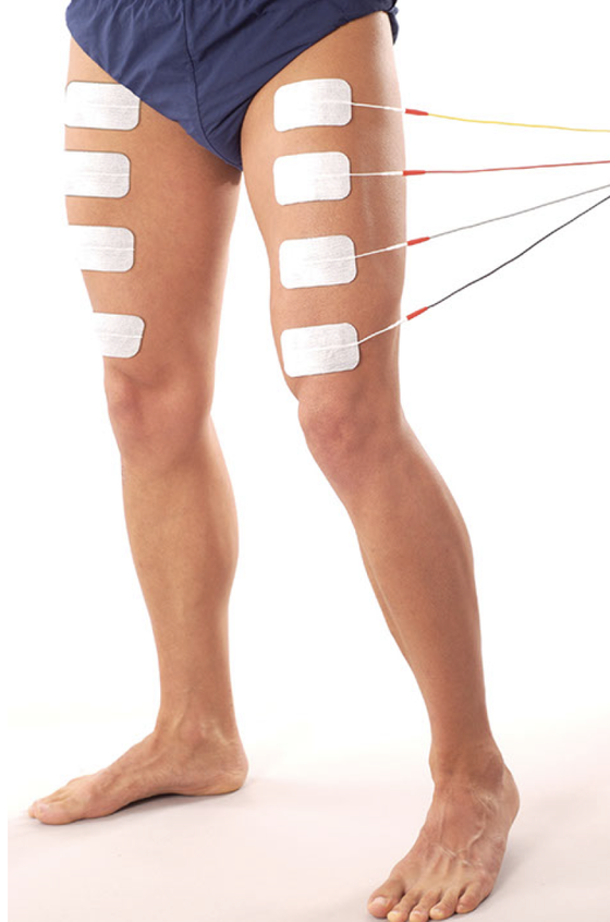 STIMEX Klebeelektroden 50 x 130 mm * mit hypoallergetischem Gel  4Stk.