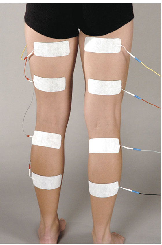 STIMEX Klebeelektroden 50 x 130 mm * mit hypoallergetischem Gel  4Stk.
