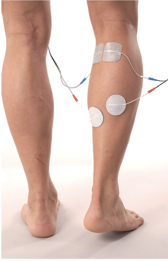 STIMEX  Klebeelektroden 32 mm rund  *mit hypoallergetischem Gel  4Stk.