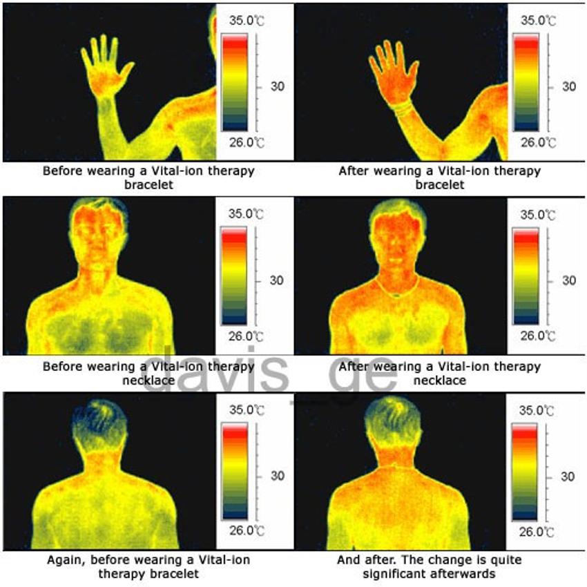Bio Magnetic 4 Elements Germaniumarmband